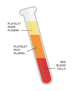 HHC PRP-treatment test tube
